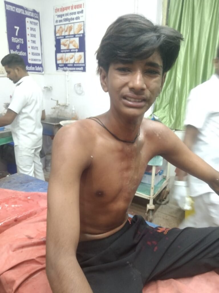 धमतरी में आधी रात खूनी बवाल: दो पक्षों में हिंसक झड़प, तेजाब हमले में 3 झुलसे, एक की हालत गंभीर 1001955359