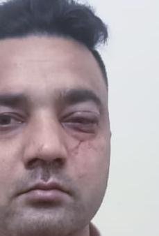 सड़क पर गिरे पेड़ से टकराई बाइक, युवक गंभीर घायल 1002124194